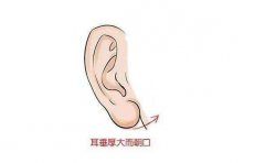 乐山自体脂肪丰耳垂医院有哪些,实力靠谱