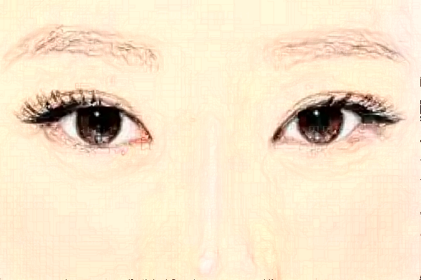 去眼角细纹失败修复恢复期是多久?