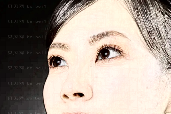 广州美莱激光去除抬头纹能维持多久?