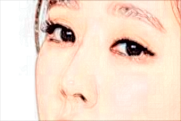 北京京城像素激光刘梅医生实力何如?