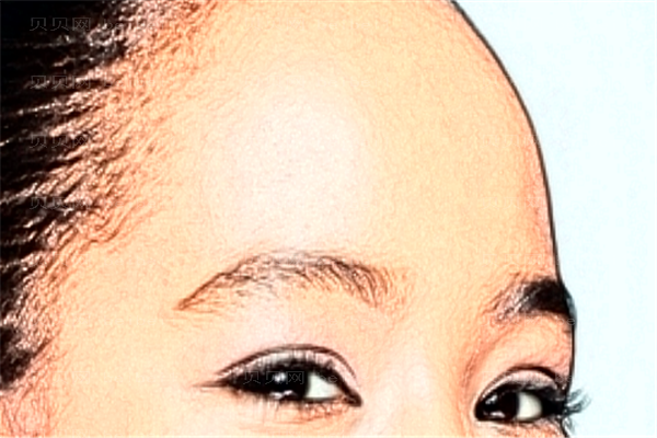 广州曙光去抬头纹失败修复好不好?
