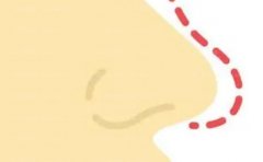 兰州假体修复医生名单全新推出名单整理