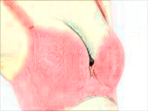 武汉江城隆胸修复口碑医生有哪些?