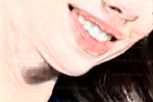 共振吸脂去掉双下巴有没有什么后遗症?