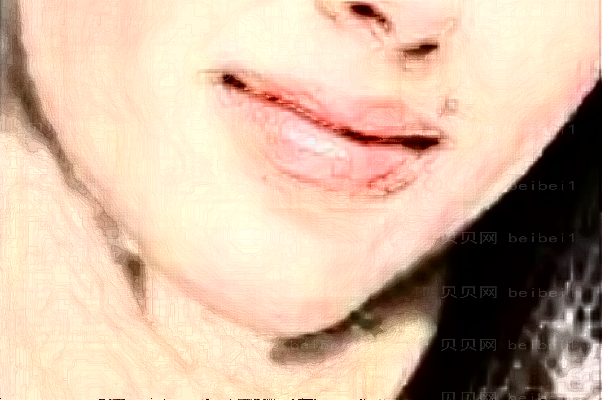 重庆当代下颌骨截骨后推安可忍医生做得好不好？
