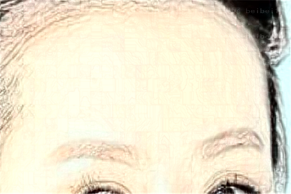 成都画美激光除眉间纹哪些哪些医生做得不错?