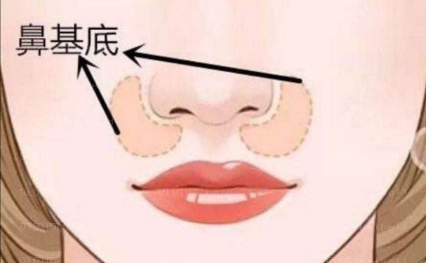 株洲去法令纹好的医生名单来咯,全新公布
