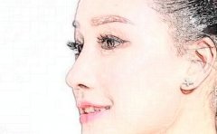 兰州眼角提升医生名单一览