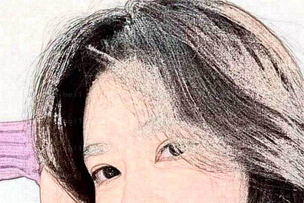 长沙素妍去脂肪粒怎么样?