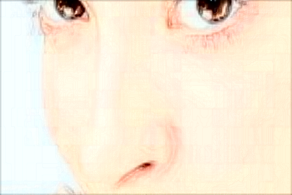 郑州缔莱美伊维兰除皱汤芳芳医生怎么样?