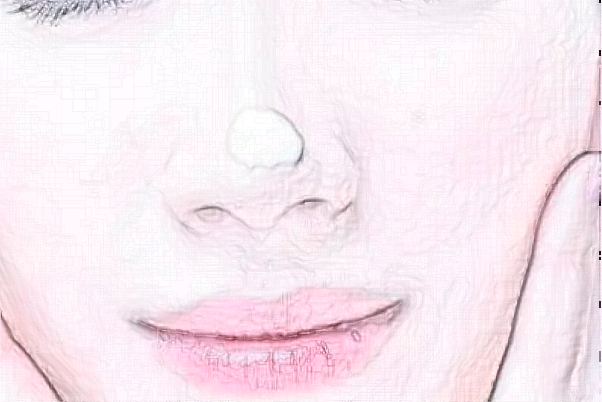 长沙申美鼻小柱缺损修复吴凯医生好不好?