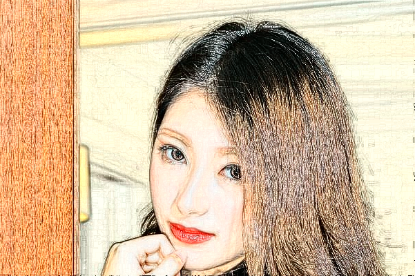 深圳美莱玻尿酸去抬头纹黄海龙医生怎么样?
