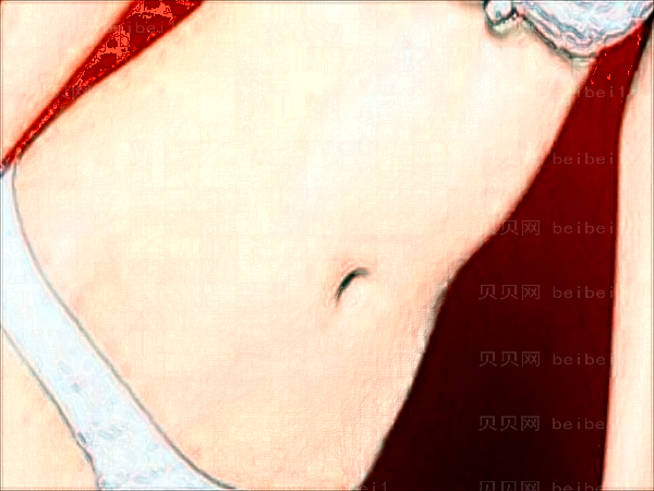 武汉仁爱时光腹部吸脂王彬医生怎么样?