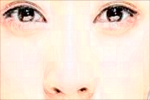 广州美莱微晶磨削去法令纹好不好?