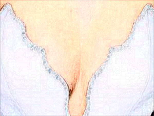成都武侯素美巨乳缩小卢元刚医生好不好?