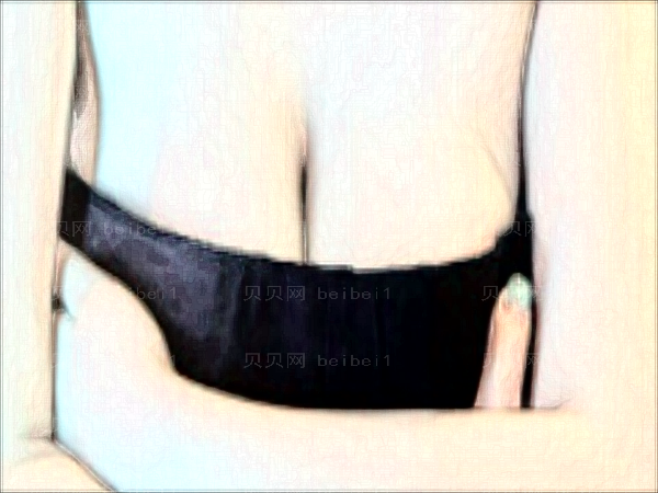 合肥台美丽格巨乳缩小怎么样?