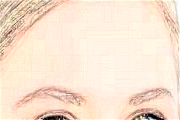 西安画美E光除抬头纹好不好?