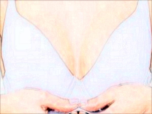 武汉亚韩真皮固定矫正乳房下垂怎么样？