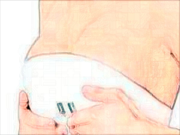 成都美容整形医院自体脂肪隆胸怎么样？