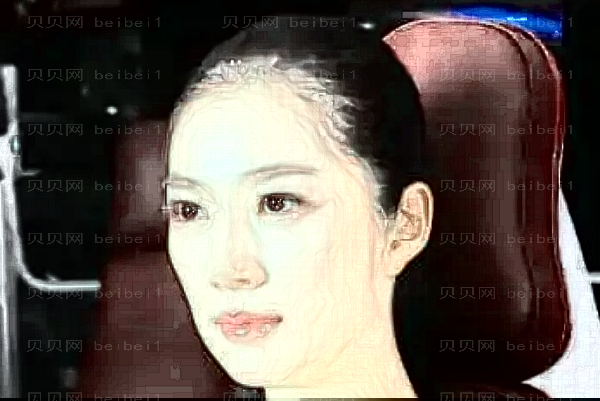武汉乐美激光去除抬头纹怎么样?