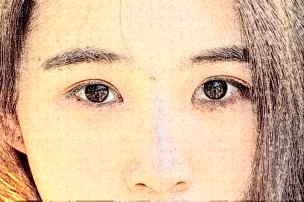 武汉艾美去眼袋失败修复好不好?