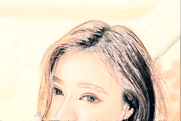 北京蜜邦玻尿酸去鱼尾纹栾志宏医生怎么样?