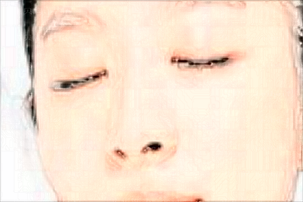 杭州时光光子去黑痣怎么样?