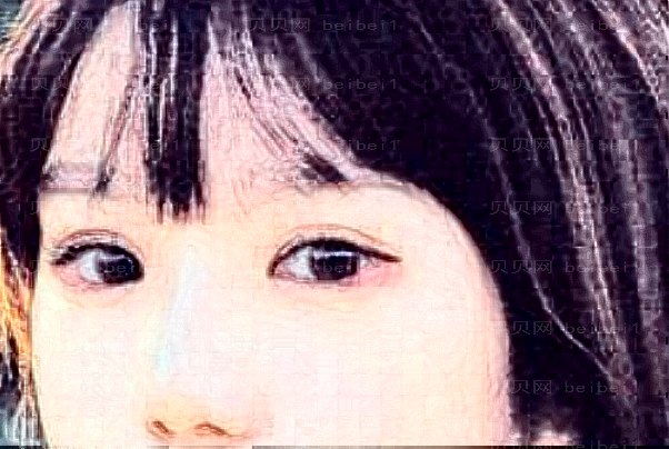 南京华美去眼袋失败修复怎么样？