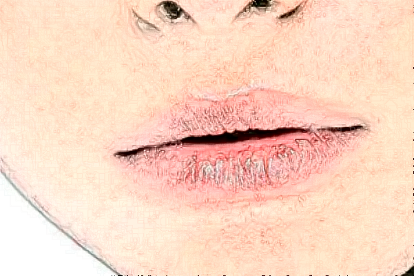 昆明韩辰唇裂修复好不好?