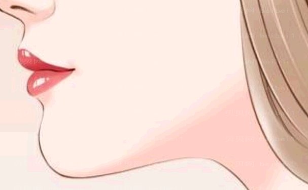 上海玻尿酸垫下巴机构介绍