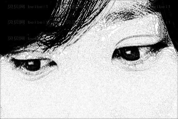 无锡坤如玛丽全切法去眼袋张凡医生好不好?