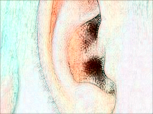 郑州二七妍琳耳部矫正修复怎么样？