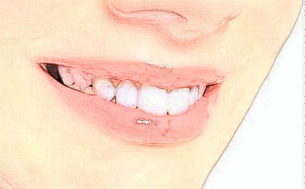 福州牙齿矫正整形医生有哪几个