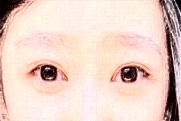 山西省整形外科医院眉弓再造术高振欣医生实力如何?