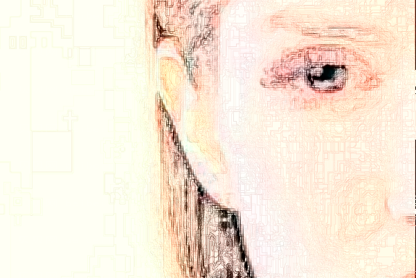 海口韩美耳部矫正修复推荐吗
