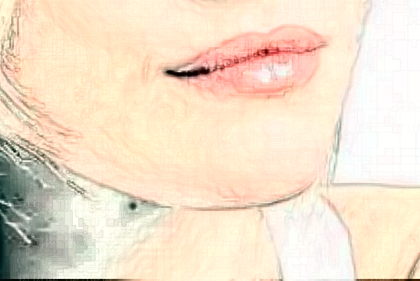 西安艾薇美玻尿酸丰下巴怎么样