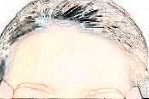 淄博壹美胶原蛋白丰额头医生有哪些