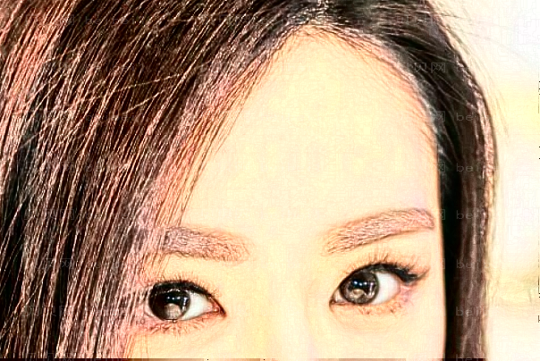 青岛华颜美眶隔脂肪释放消除肿眼泡好吗