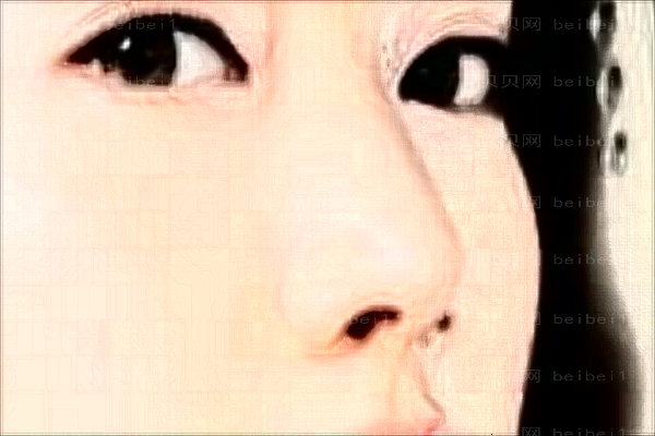 太原丽都自体脂肪垫鼻基底可靠吗