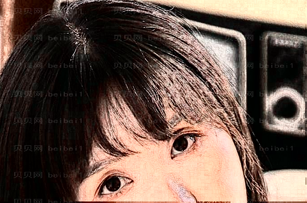 重庆郑荃丽格去除抬头纹实力如何