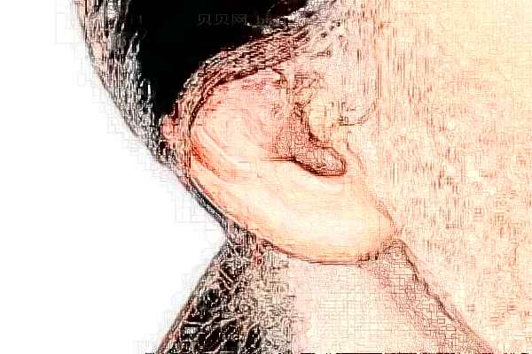 长沙贝美玻尿酸丰耳垂好吗