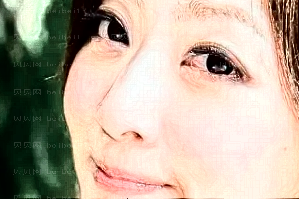 西安晶肤自体脂肪垫鼻基底哪个医生水平比较好