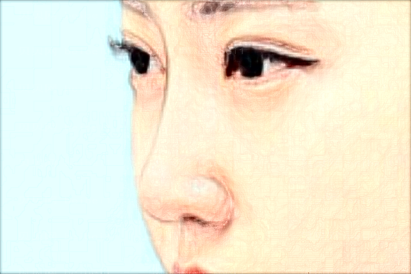 苏州美贝尔激光点痣选哪个医生
