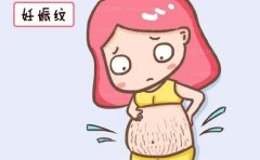 哈尔滨去妊娠纹哪个医院好一些