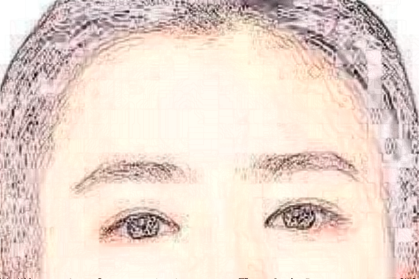 株洲韩美硅胶丰额头好吗