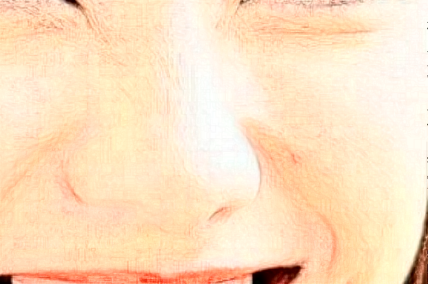 湖南雅美硅胶隆鼻可信吗