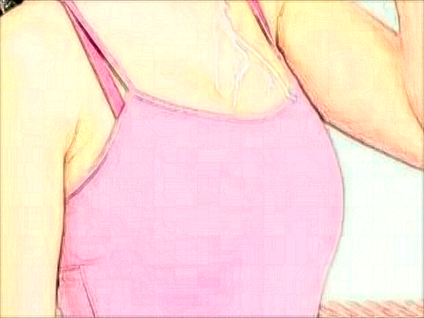 南京凤凰岛去副乳失败修复口碑好不好