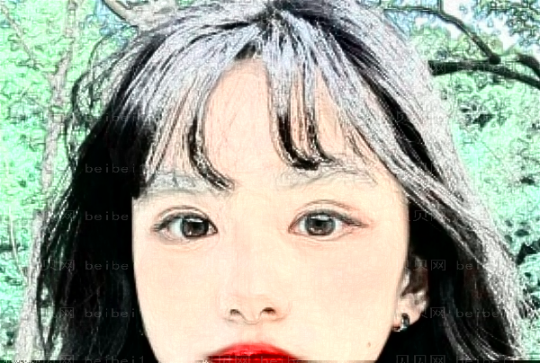 桂林冷冻去痣医院名单