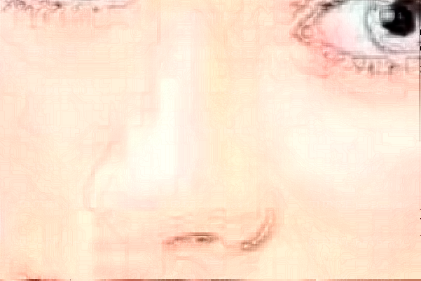 合肥恒美膨体垫鼻基底医生有哪些