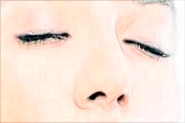 杭州连天美聚左旋乳酸去法令纹可靠吗